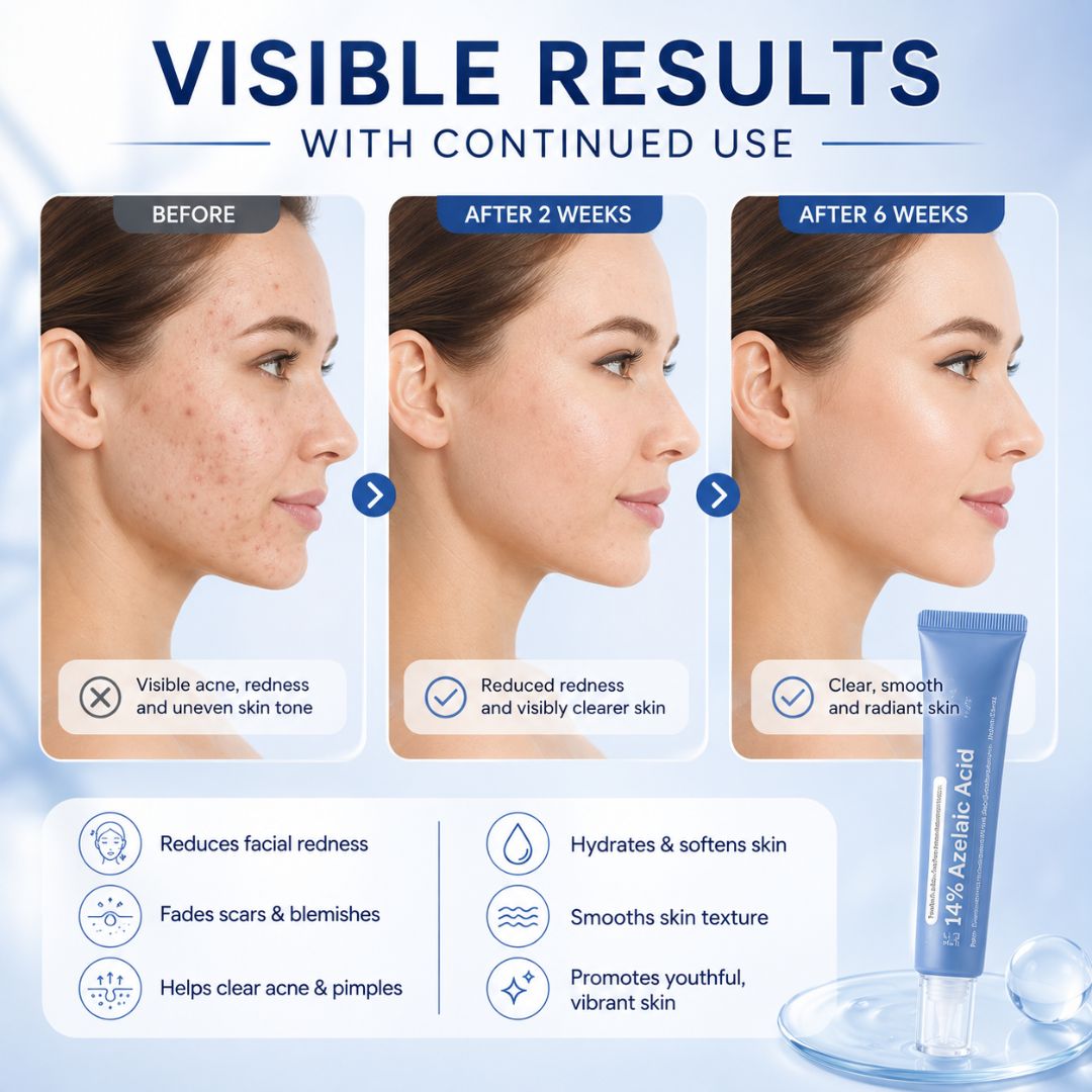 FreshDew™ Face Cream